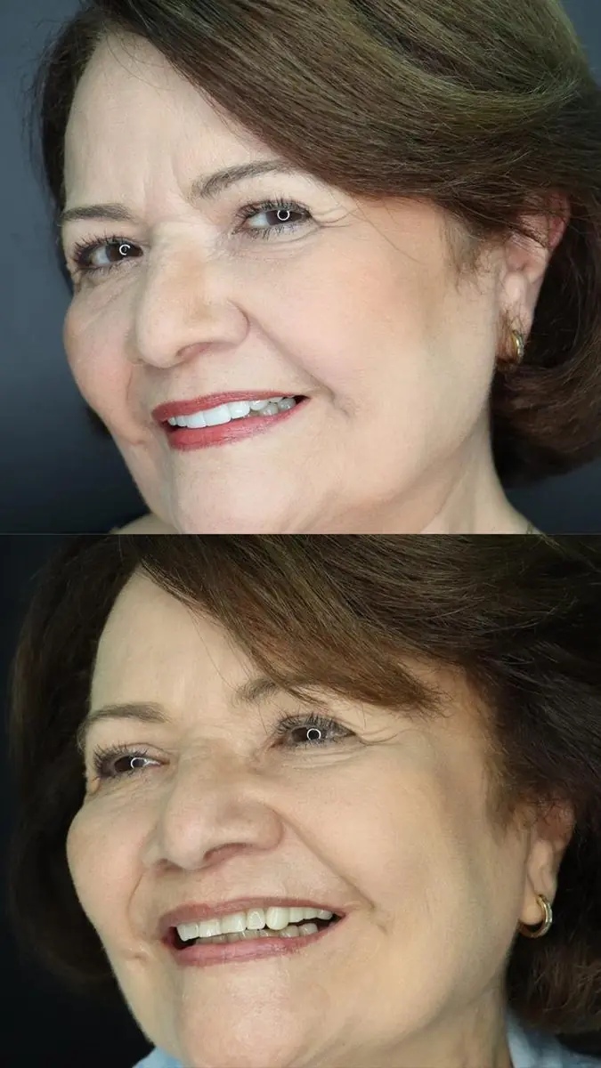 Caso real: Estética dental · retrato en Ozono Dental Group