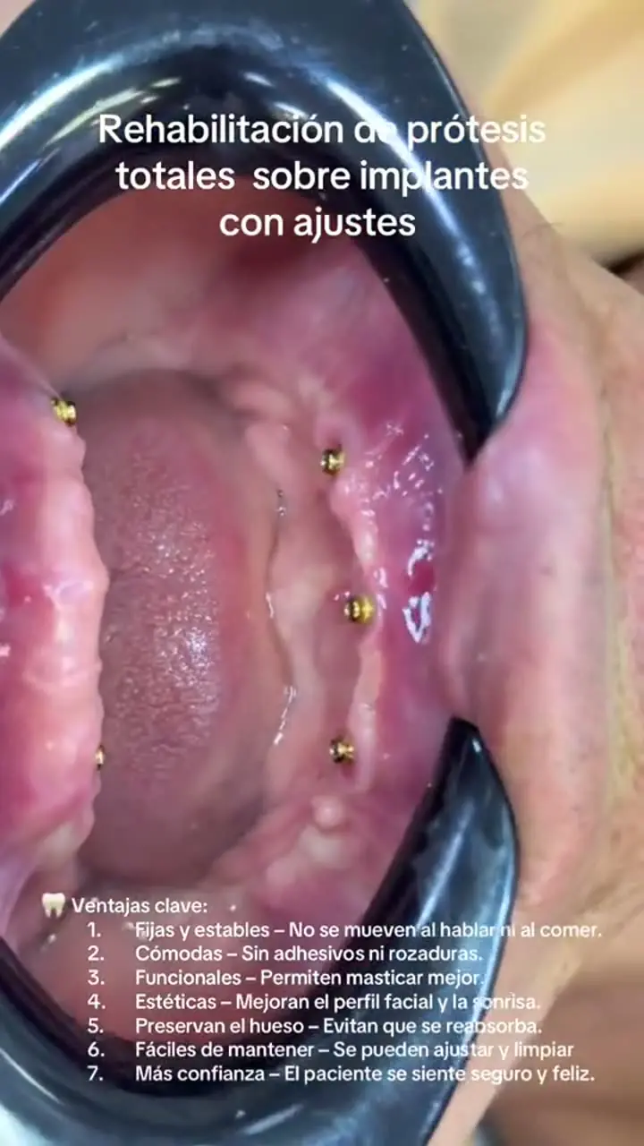 Video de paciente: Paciente Ozono Dental Group cuenta su experiencia en Ozono Dental Group